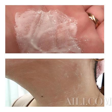 胳膊肘上起了一片一片的像鸡皮疙瘩