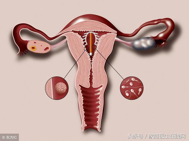 上环对身体的危害有哪些上环的危害和副作用是什么