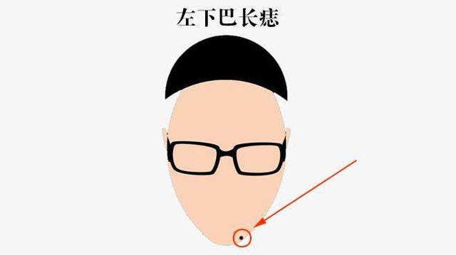 右胸长痣代表什么意思