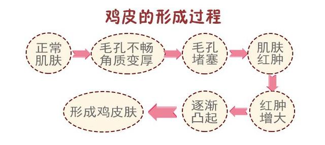 毛周角化病涂什么