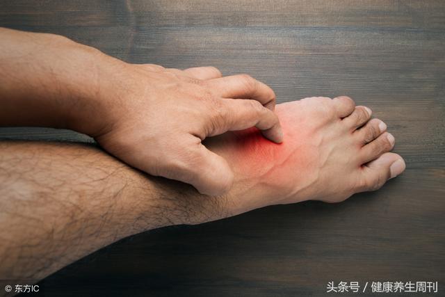 毛周角化是不是癣