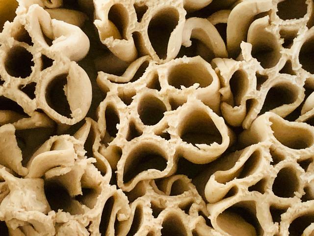 夫妻为远离肥胖、超重，主食这样吃，自律就是对自己的健康负责