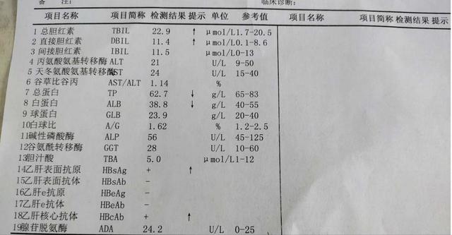 如何看自己肝功能好坏？医生建议：肝病患者少吃这些