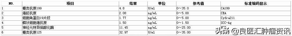 右肺上叶非角化型鳞状癌