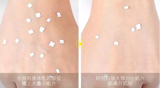 女生冬天腿上为什么会鸡皮肤很痒