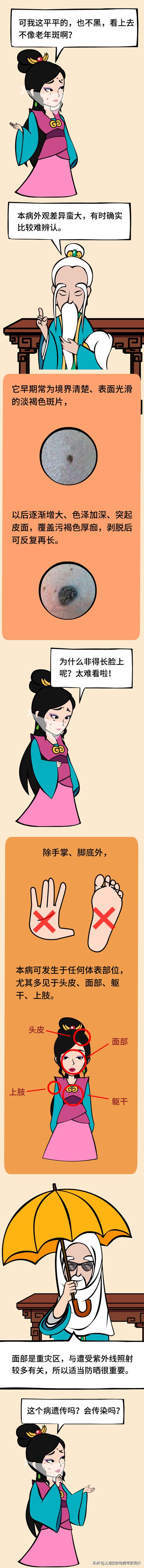 脂溢性角化症病例