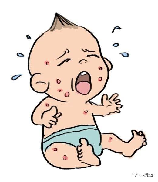六个月宝宝湿疹怎么止痒（常见病防治婴幼儿湿疹）(6)
