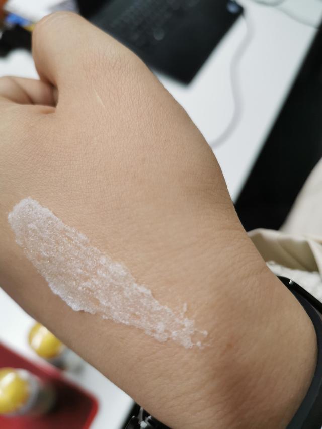 鸡皮肤俗称雀皮