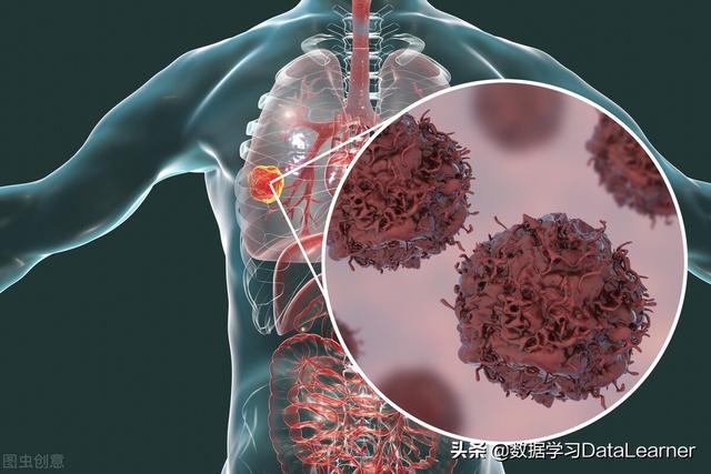 计算机视觉（Computer Visions）在医疗领域的十个应用