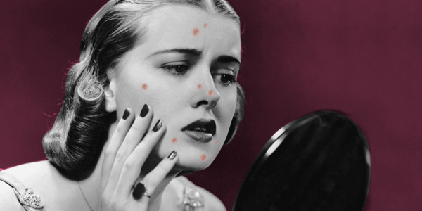 毛囊角化里面挤出来是白色的吗