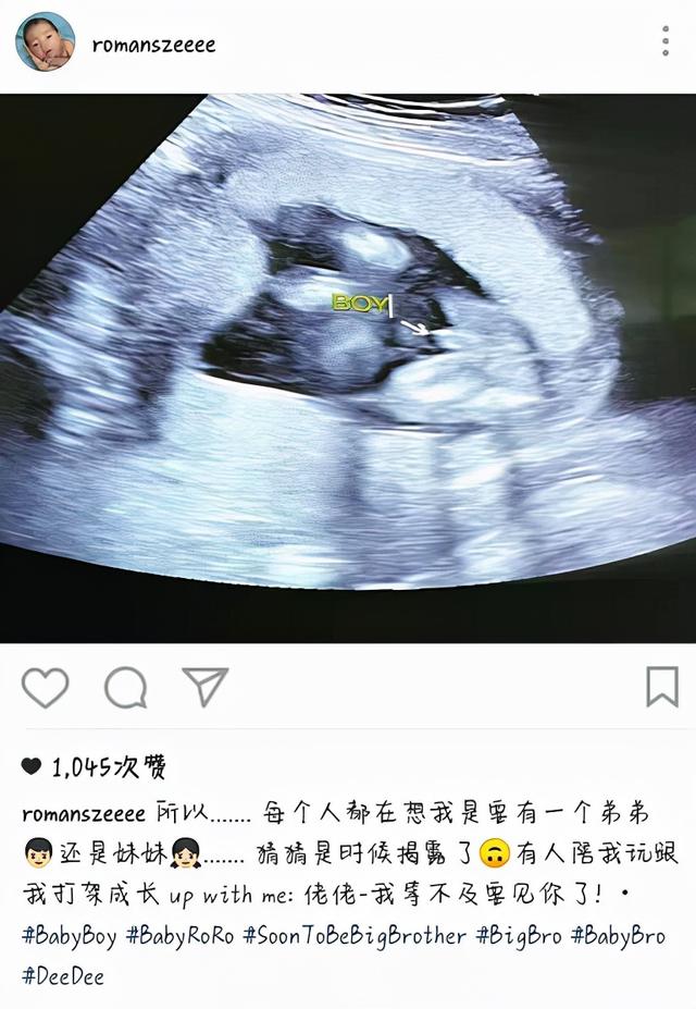 38岁的TVB小花公开二胎性别！和小8的老公在一起三年，被查出卵巢肿瘤。
