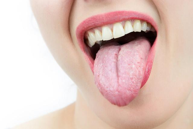 观舌头，知健康！舌色、舌形、舌苔反映身体隐疾，7种变化要知晓