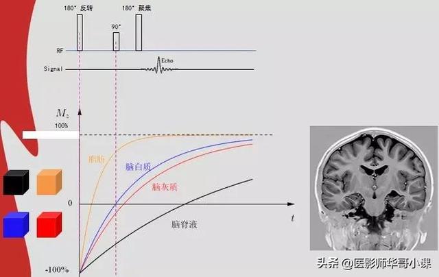 mri检查婴儿t1hi高是什么意思