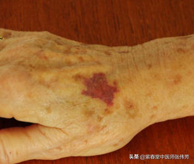 手臂上突然有很多小红点