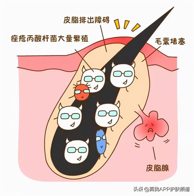 角化过度和角化不良