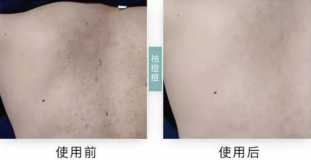 坚持涂绿茶身体乳