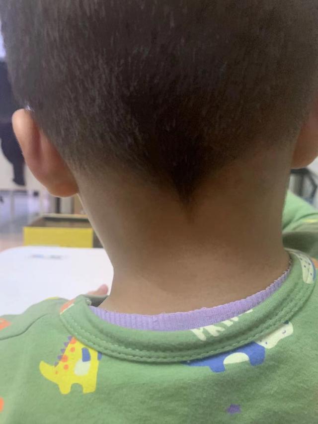 羊水穿刺到底有多疼—记录我产检过程中最煎熬的过程