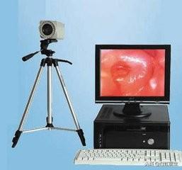 子宫角化型鳞癌能治好吗