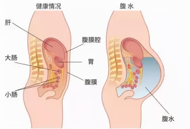促排取卵时，医生建议的“高蛋白饮食”到底怎么吃？