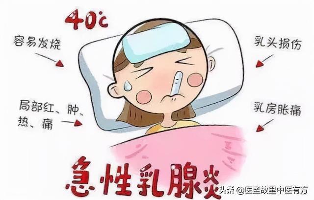 中药名方 瓜蒌牛蒡汤 治疗急性乳腺炎疗效显著 建议收藏转发 Zh中文网