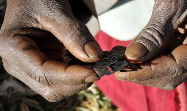 什么是割礼什么是割礼的图片