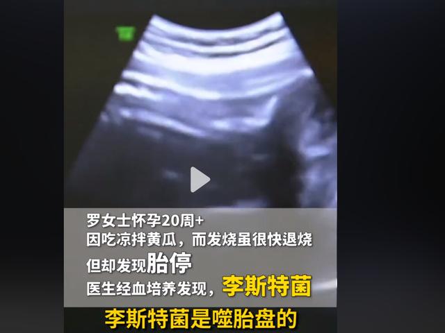 孕妇过夏天，做好"4防"工作，让妈妈身心舒适，胎儿健康成长