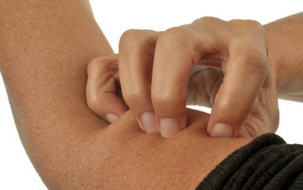 身上若2处“发痒”，很遗憾告知你：血糖超标了，请赶紧调整