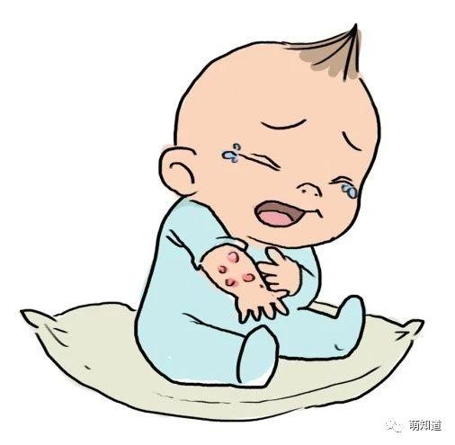 六个月宝宝湿疹怎么止痒（常见病防治婴幼儿湿疹）(3)