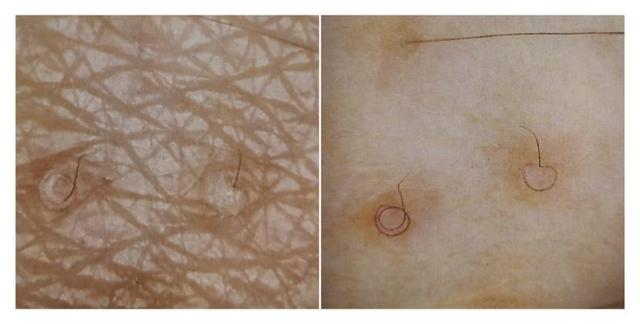 delon身体乳会长毛吗