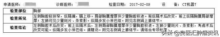 右肺上叶非角化型鳞状癌
