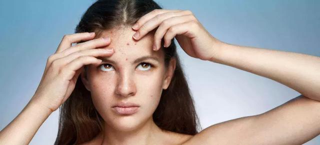 毛囊角化里面挤出来是白色的吗