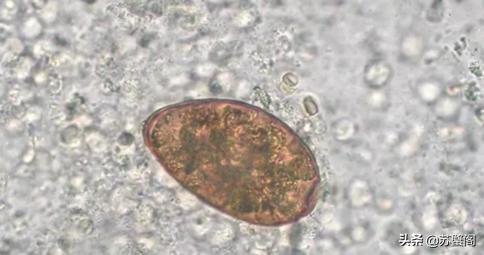 你还在吃生腌吗？就不怕中招吗