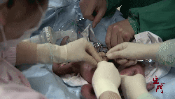 我目睹了一场疯狂的“中国男胎战争”