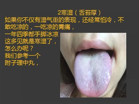 齿痕重是脾虚，舌苔厚也是脾虚吗？怎样把舌苔变薄、齿痕消失呢？