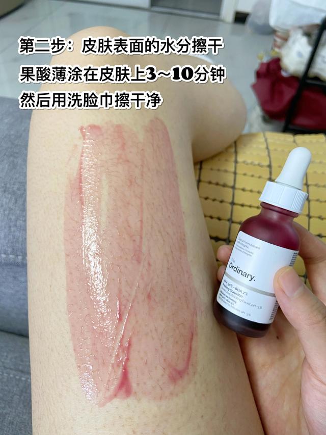 男友会接受女友有鸡皮肤吗