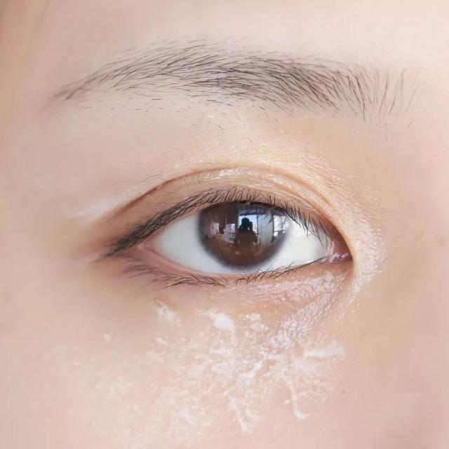 皮肤疙疙瘩瘩是鸡皮吗
