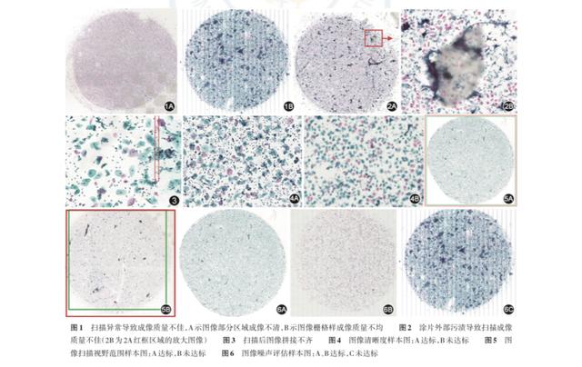 宫颈基液细胞检查是什么意思