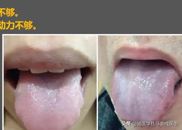 六种不同常见体质，看你属于哪种，看哪种方法适合你