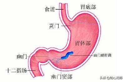 胃检查ph十是什么意思