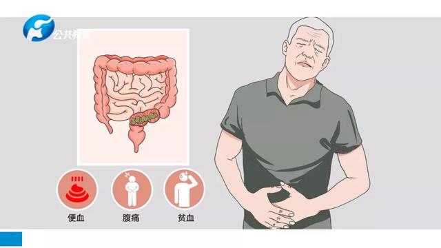 年轻并无金刚罩 消化道肿瘤莫忽视 | 河南省直第三人民医院消化病中心主治医师赵锦华