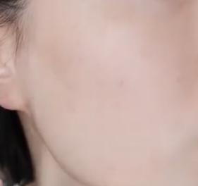 去毛周角化用什么药膏