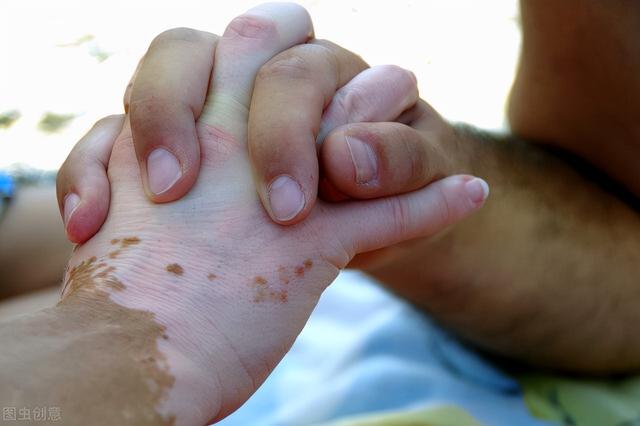 皮肤疾病是怎么引起的？掌握5个规律，可提高有效诊断和治愈率