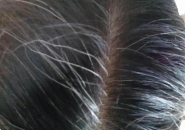 有了白发先别着急染发，多吃这5种食物，或许能改善