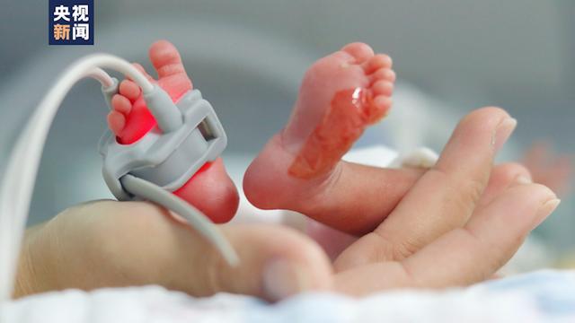 早产4个月婴儿被医护救下，出生体重不到2斤