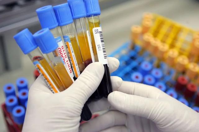 孕期白细胞增多正常的？