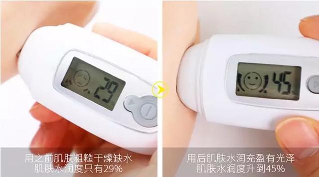 女生冬天腿上为什么会鸡皮肤很痒