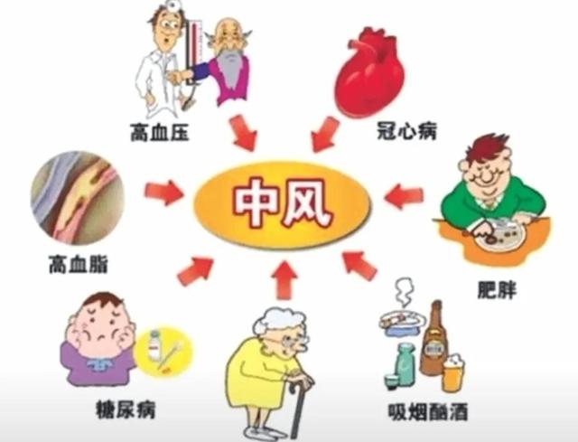 被人们忽略的中风先兆