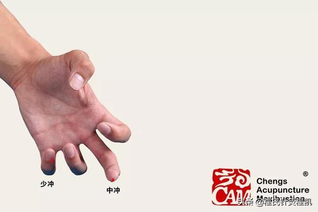 程凯养生说：心血不足，手上有表现