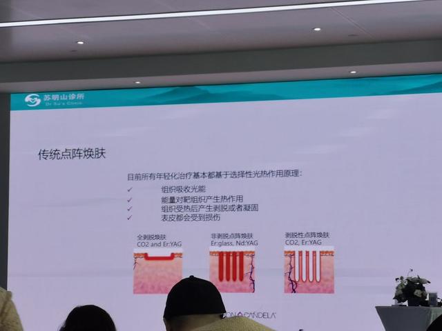 皮秒可以去汗管角化吗