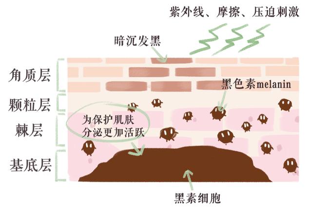 毛周角化黑色素沉着